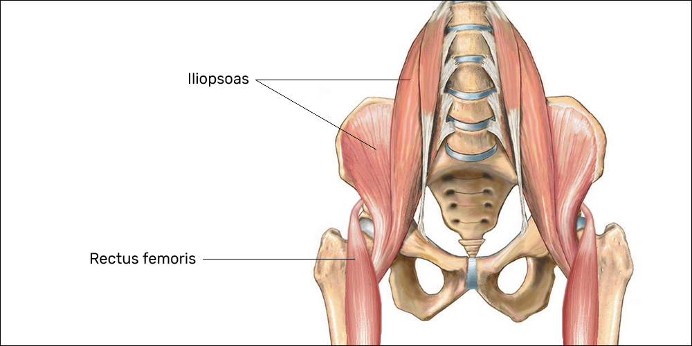 The iliopsoas and rectus femoris are hip flexors affected in lower crossed syndrome