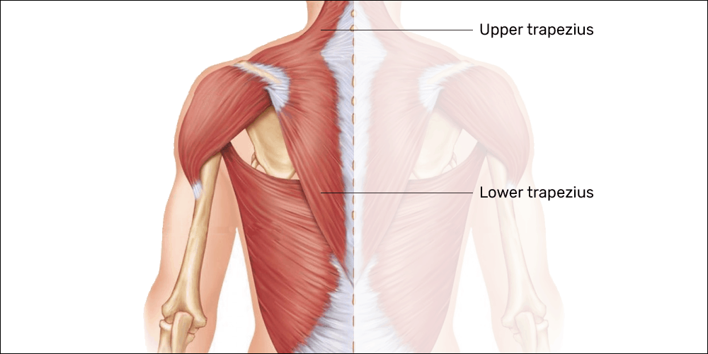 Tightness occurs in the upper trapezius and weakness occurs in the lower trapezius