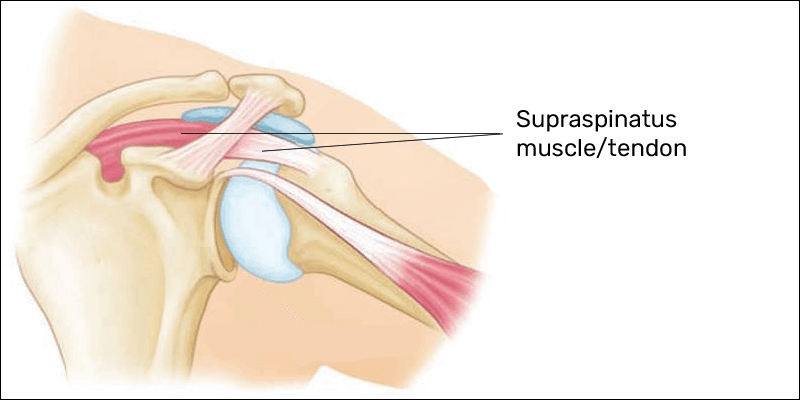 supraspinatus muscle