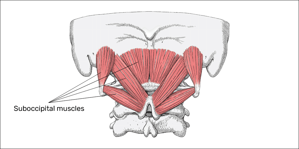 Tension-type headaches suboccipital muscles